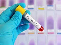 عوارض مصرف بیش از حد ویتامین D