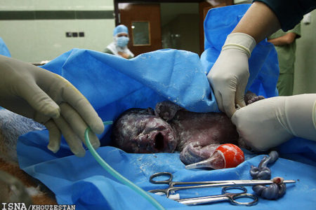 لزوم اصلاح معایب قانون «جوانی جمعیت»/ فرصت یک هفته‌ای؛ ناکافی برای صدور جواز سقط