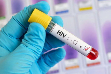 HIV چگونه منتقل می‌شود و راه‌های پیشگیری از آن چیست؟