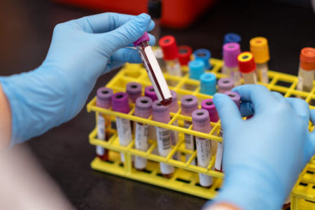 شناسایی نشانگر زیستی افسردگی و پاسخ ضد آن