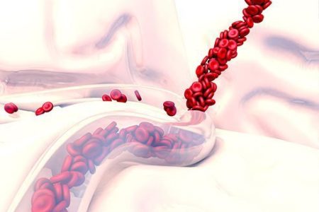 عوامل و علائم خونریزی داخلی