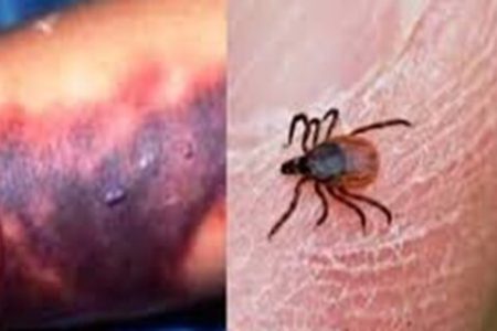 راهکارهای پیشگیری از “تب خونریزی‌دهنده کریمه کنگو” در آستانه عید قربان