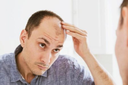 درمان “پی‌آرپی” برای ریزش مو چیست؟