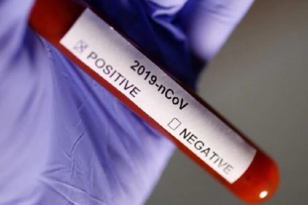 آمار جهانی کرونا؛ ابتلای بیش از ۶۳۶ میلیون نفر به کووید-۱۹