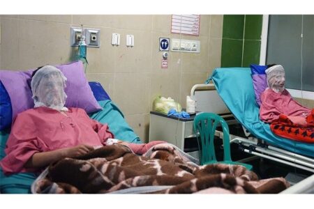 سوختگی در ایران؛ از بحران کمبود تخت تا هزینه‌های گزاف درمان