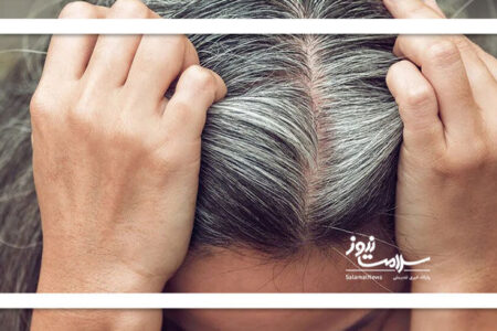 طب سنتی و علت سفیدی موها