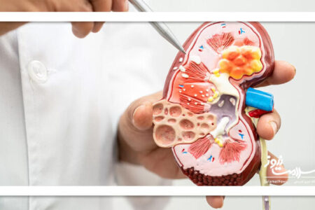 ۱۰ درمان خانگی مؤثر برای دفع سنگ کلیه